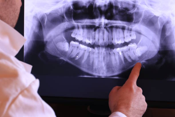 Best Emergency Treatment for Dental Infections or Abscesses in Lake Isabella, MI