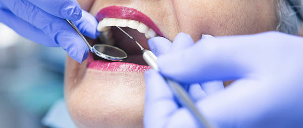 Best Cosmetic Emergency Dentistry in Lake Isabella, MI